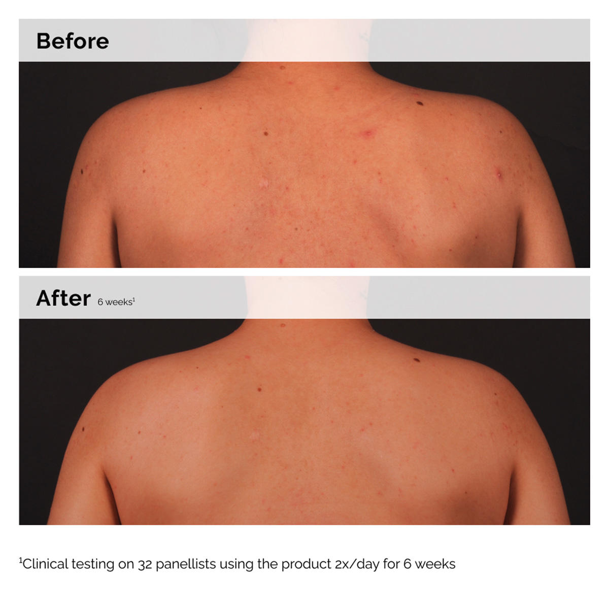 The Ordinary Salicylic Acid 0.5% Body Serum 240 ml - 3