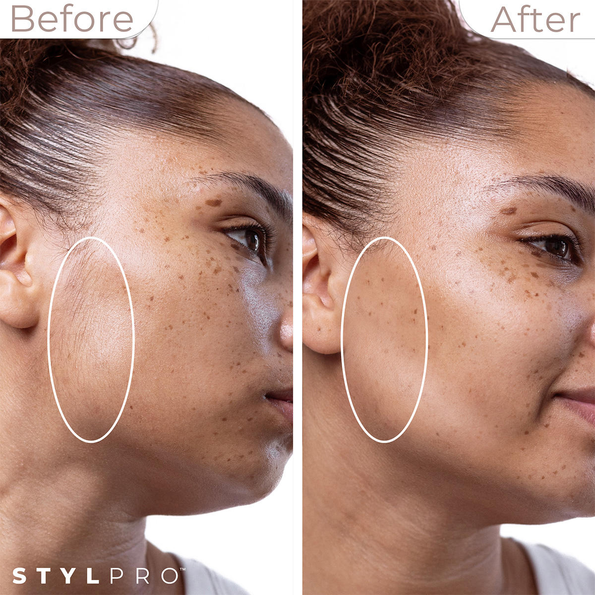 STYLPRO 2-in1 Sonic Dermaplane  - 3