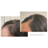 Virtue Flourish Hair Rejuvenation Treatment 1 month supply Set  - 4