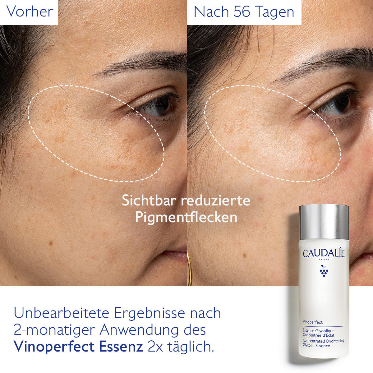 CAUDALIE Vinoperfect Esencia con ácido glicólico 100 ml - 4