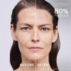 Shiseido Bio-Performance Skin Filler Serum Set Navulling 60 ml - 5