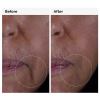 The Ordinary GF Solution 15% 30 ml - 5