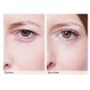 Wonderstripes Eyelid correction Size S 64 pieces per package - 6
